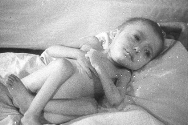 Jedno z niemowląt znalezionych w Auschwitz po wyzwoleniu. Zdjęcie domena publiczna.
