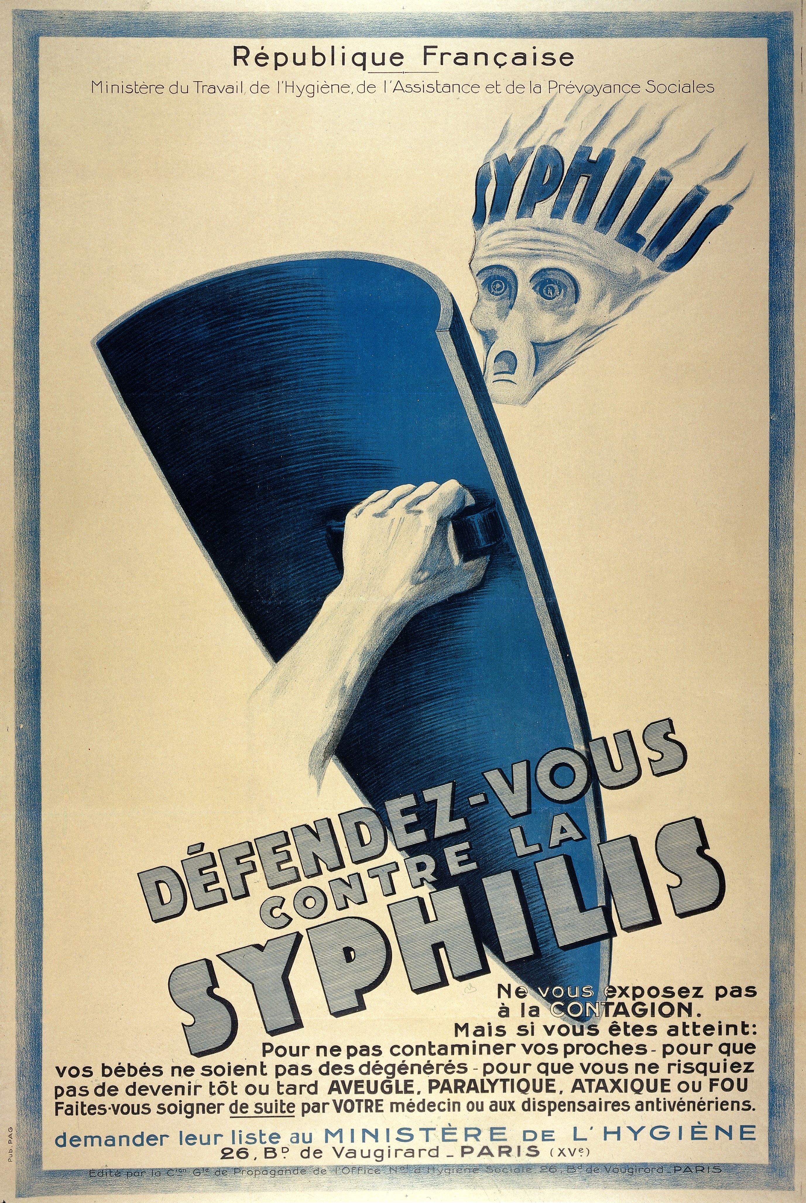 Francukie władze jeszcze przed I wojną światową wzywały do chronienia się przed syfilisem (fot. Wellcome Images, lic. CC BY 4.0).