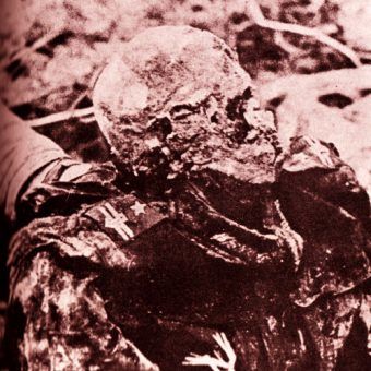 1943 rok, ekshumacja grobów polskich oficerów w Katyniu, ciało jednej z ofiar 1943 rok, ekshumacja grobów polskich oficerów w Katyniu, ciało jednej z ofiar