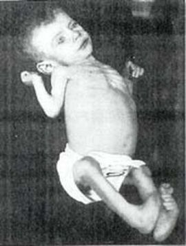 Zagłodzone niemowlę z okresu I wojny światowej uratowane z rąk amerykańskich "fabrykantek aniołków".