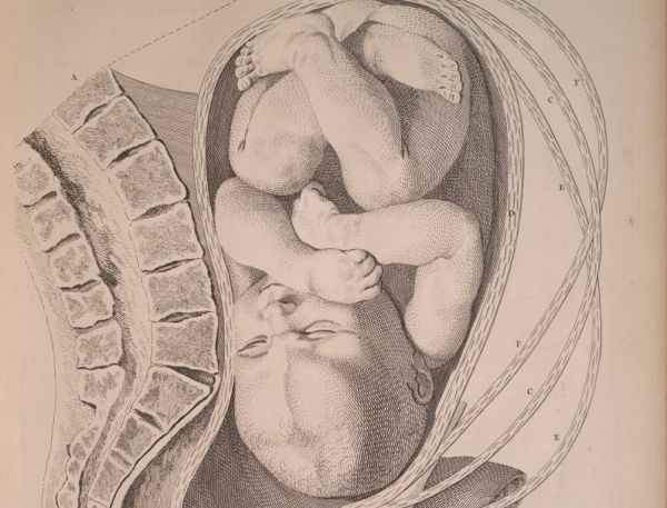 Rysunek z pracy anatomicznej Williama Smelliego. Tchnie spokojem? Tylko do chwili, gdy zaczniesz zadawać pytania o to, jak powstał… Rysunek z pracy anatomicznej Williama Smelliego. Tchnie spokojem? Tylko do chwili, gdy zaczniesz zadawać pytania o to, jak powstał…