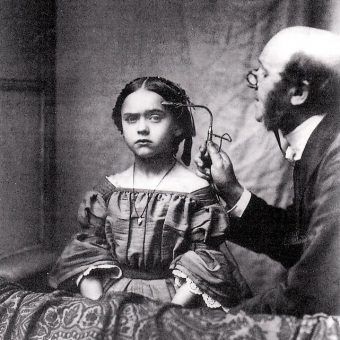 Leczenie chorej umysłowo dziewczynki na fotografii zamieszczonej w XIX-wiecznym francuskim podręczniku medycznym.