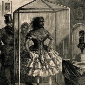 Julia Pastrana, czyli "Dama Pawian", była pokazywana tak za życia, jak i po śmierci. Podobny los spotkał jej zmarłe niedługo po urodzeniu dziecko. Julia Pastrana, czyli "Dama Pawian", była pokazywana tak za życia, jak i po śmierci. Podobny los spotkał jej zmarłe niedługo po urodzeniu dziecko.