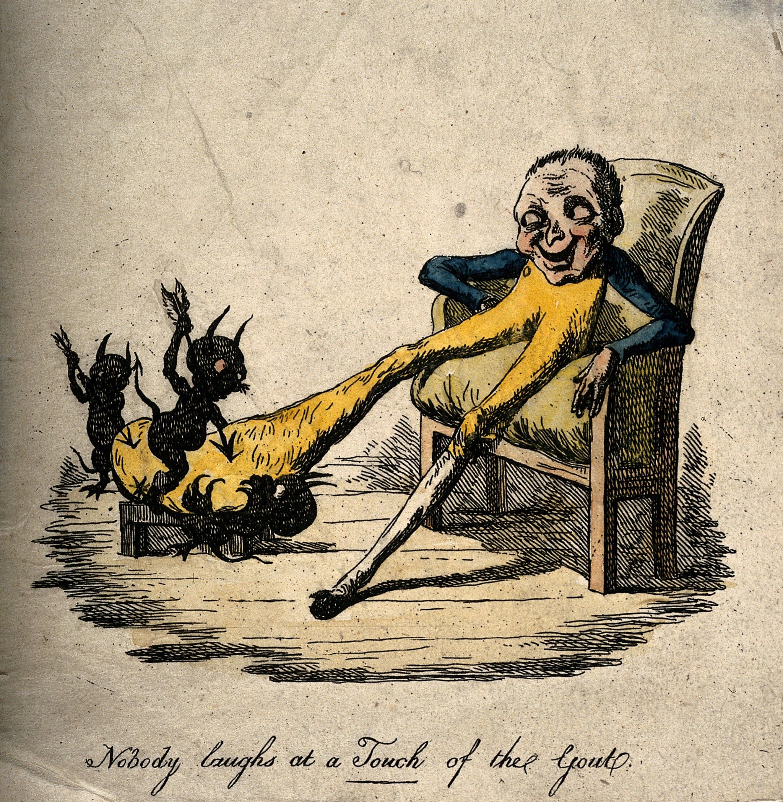 Mężczyzna cierpiący na podagrę na XIX-wiecznej ilustracji (fot. domena publiczna)