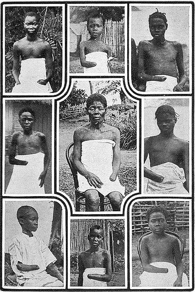 Kalekie dzieci z Kongo