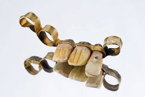 Już Etruskowie tworzyli prymitywne protezy zębowe
