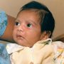 Baby Fae